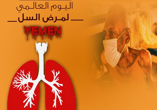 السل